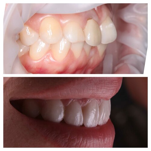 Стоматологическая клиника «CHILANZAR DENTAL SERVIS»